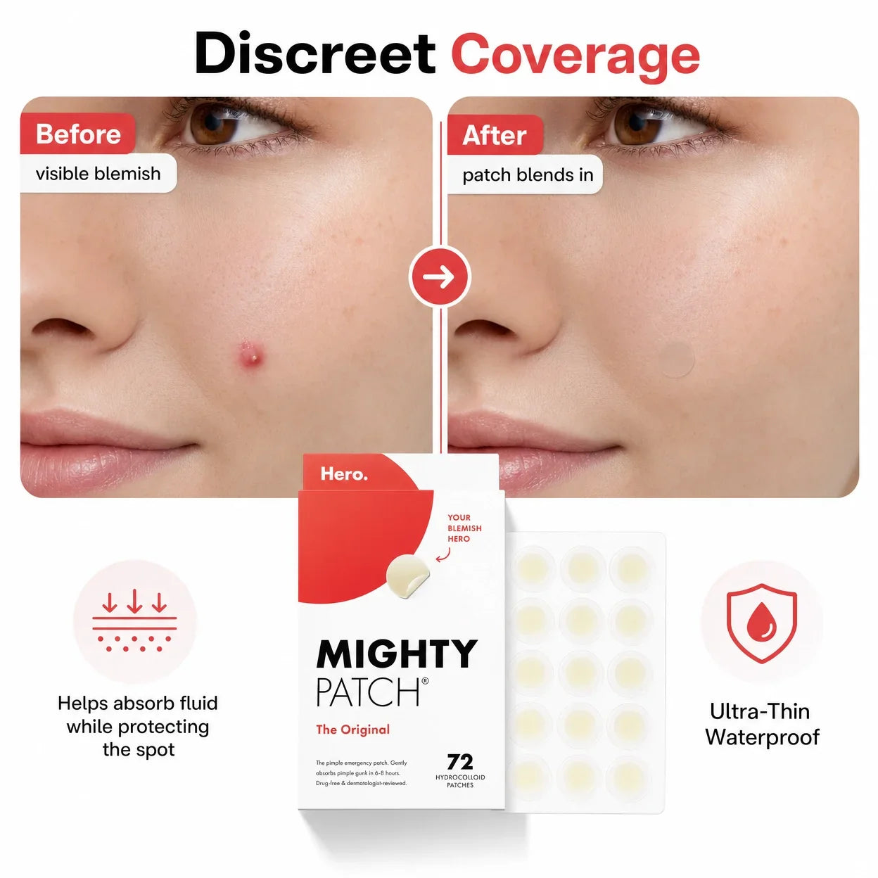 HERO Mighty Pimple Patch, Acne-Free Skin Overnight Solution